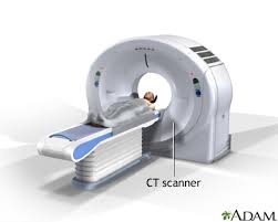 سی تی اسکن , ct scan